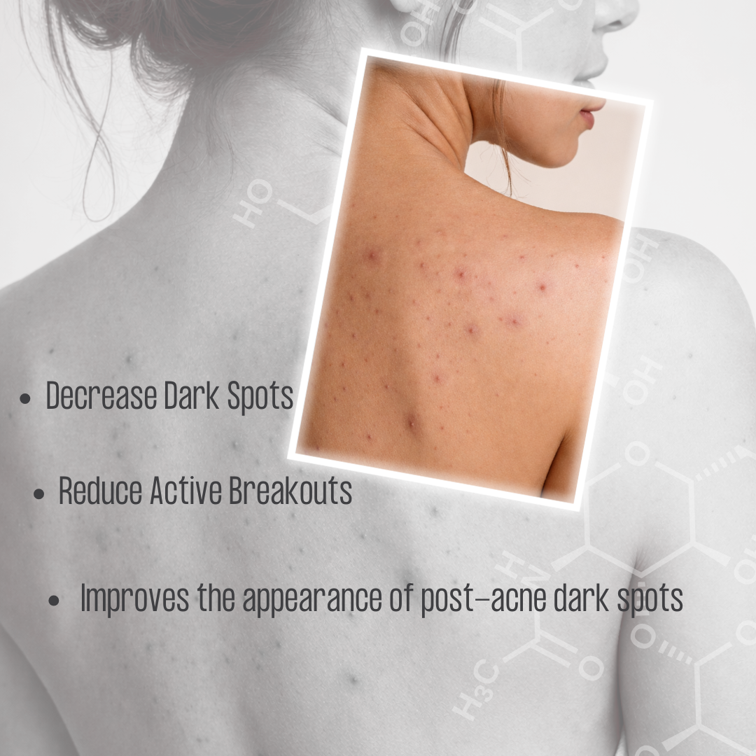 Hyaluronic Acid CLEAR™ | Daily Clarifying + Tone-Correcting Body Serum | Hexluron™